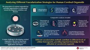 Different Vascularization Strategies for Human Cerebral Organoids