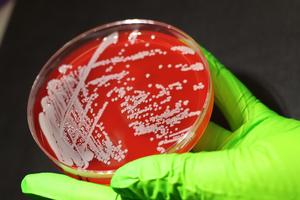 Staphylococcus aureus growing on plate