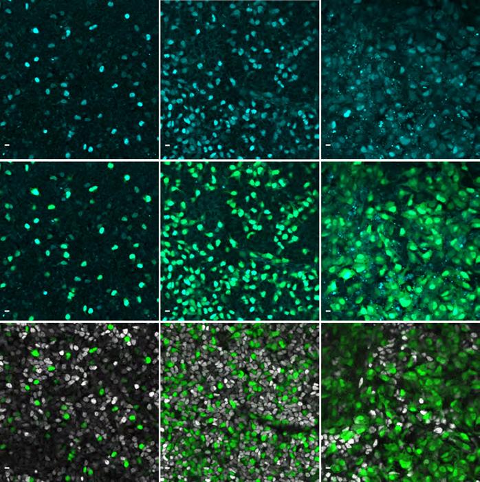 NEUROG3 in cyan in human pancreatic cells