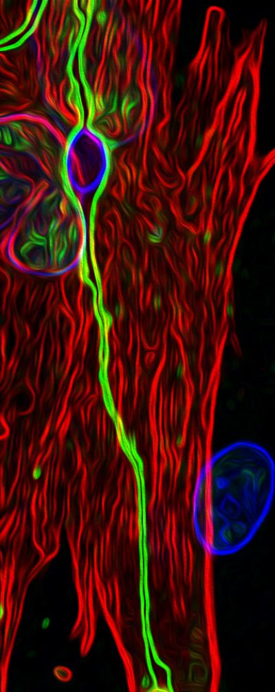 New Salk Method Efficiently Grows Human Astrocytes in a Dish, Advancing Studies of Stroke, Alzheimer