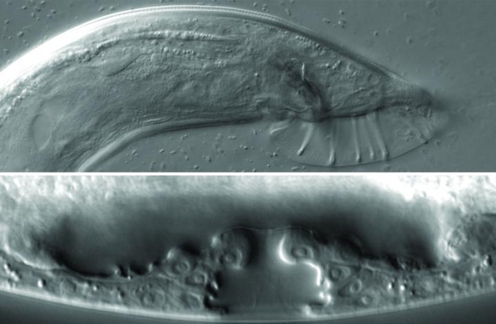 <i>C. elegans</i> Sexual Organs