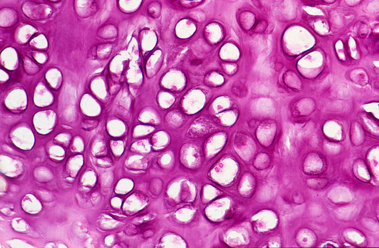 Chondrocytes