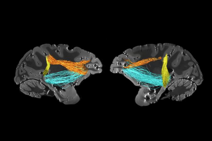 Attentional Control in Brain