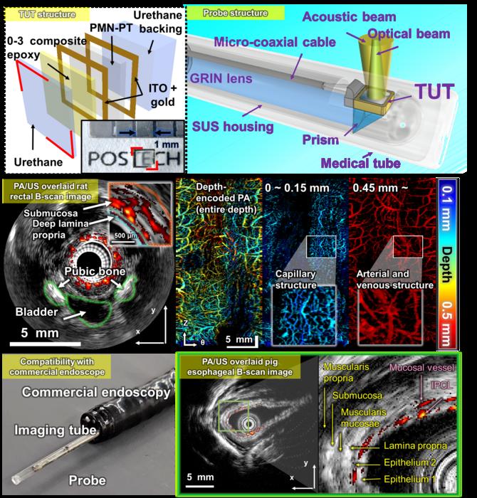 A transparent ultrasound transducer-based photoacoustic-ultrasound fusion probe, along with images of a rat’s rectum and a pig’s esophagus