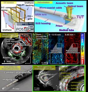 A transparent ultrasound transducer-based photoacoustic-ultrasound fusion probe, along with images of a rat’s rectum and a pig’s esophagus