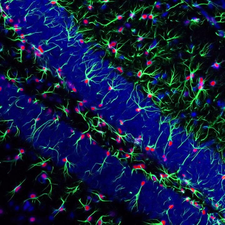 Staining for neural stem cells expressing SOX2 (red) and GFAP (green)