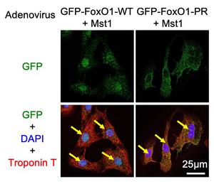 Mst1 phosphorylates FoxO1, finds a study in Nature Communications