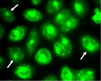 PAHs and Lung Cancer