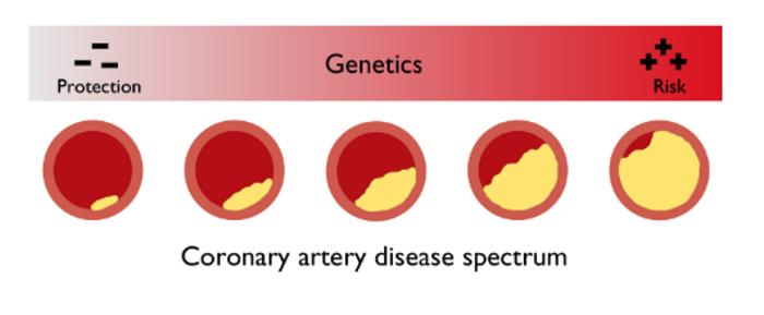 Coronary artery disease spectrum