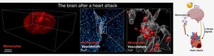 Images of monocytes in the brain after a heart attack and schematic of the findings