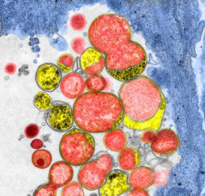 Chlamydia Mutants are Defective in Secreting Virulent Proteins