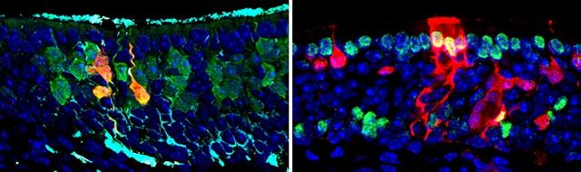 Transplanted Cells Generated All Cell Types of the Nasal Tissue