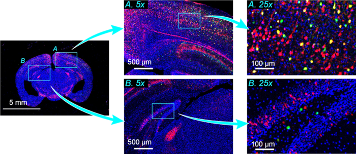 Fig.1: Imaging a mouse brain slice.