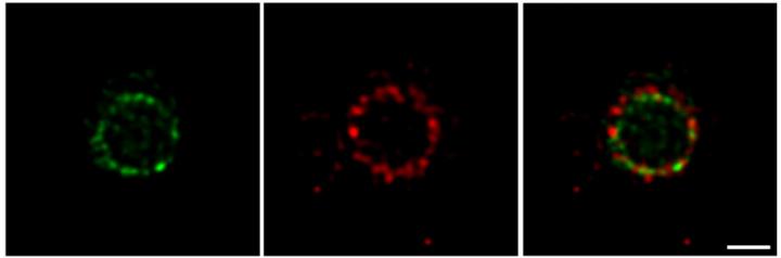 Protein Rings in the <i>E. coli</i> Divisome