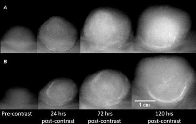 Bellamkonda X-ray Images