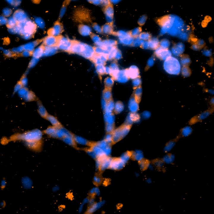 Cellular Networks Stained for the Presence of Basement Membrane Proteins