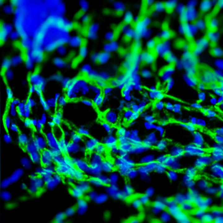 Creating Blood Vessels on Demand