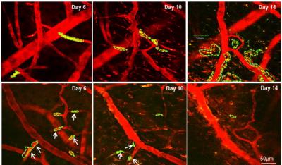 Intravital Two-photon Microscopy Images