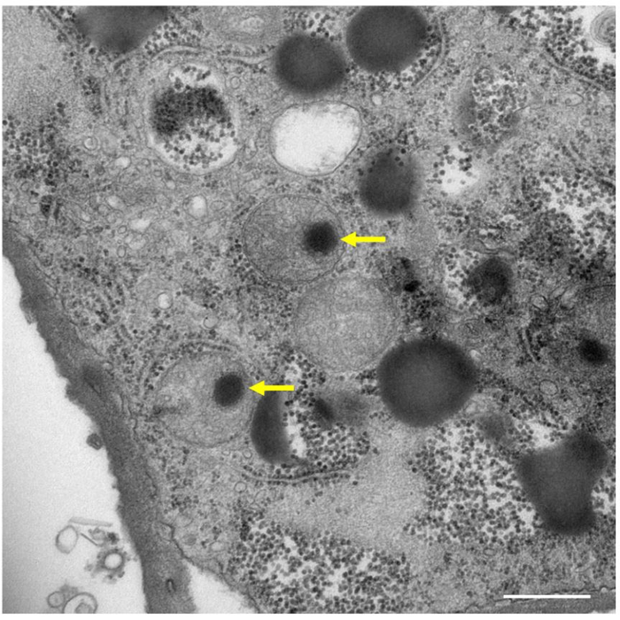 Medusavirus entering the mitochondria (yellow arrows) of a cyst amoeba cell