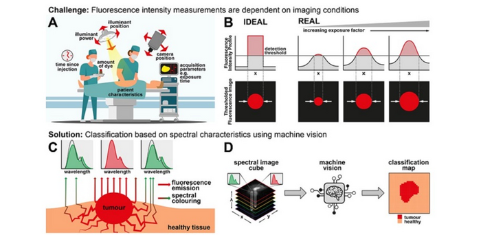 Machine Learning Combines with Multispectral Infrared Imaging to Guide Cancer Surgery