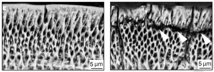 High-Magnification of Tooth Enamel in Mice