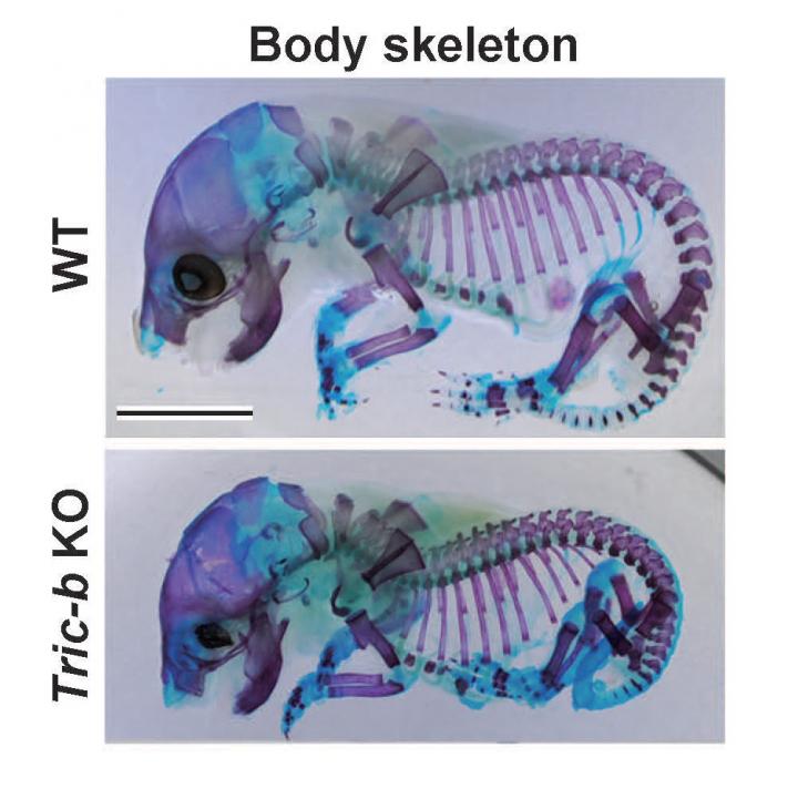 Mutation in Brittle Bone Disease Link EurekAlert!