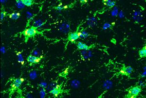 Inflammatory microglia from a female brain in a mouse model of Alzheimer's disease. The mice also carry the APOE4 and TREM2 genetic risk factors. Yellow dots indicate that these microglia exhibit a senescent phenotype.