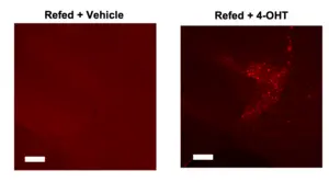 Researchers pinpoint brain cells that delay first bite of food