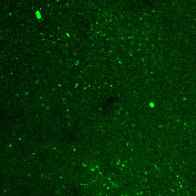 miRNA-9 Transfection in Brain Tissue