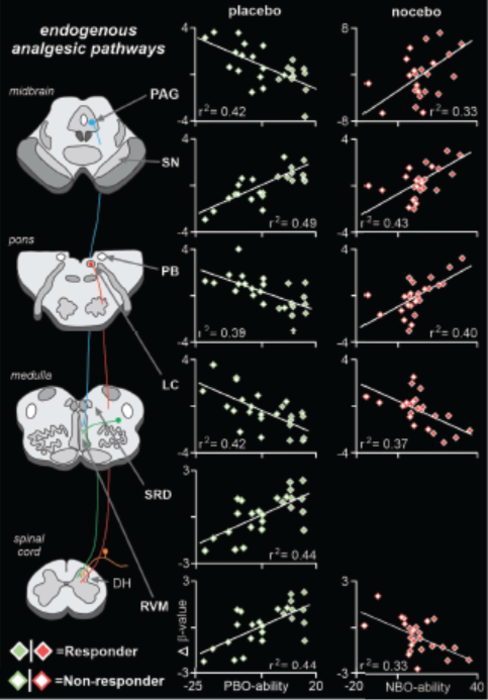 Brainstem Pathway Modulates Pain in Placebo Effect