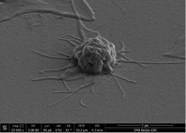 Activated Thrombocyte