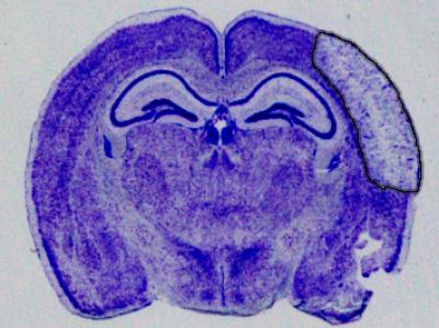 Stroke Size Without Gap 19 treatment