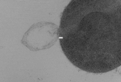 Cell Experiencing Lysis (2 of 2)