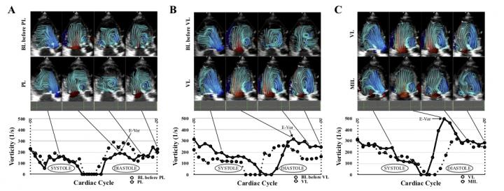 Graphs of the vorticity during the cardiac cycle in a dog under various conditions