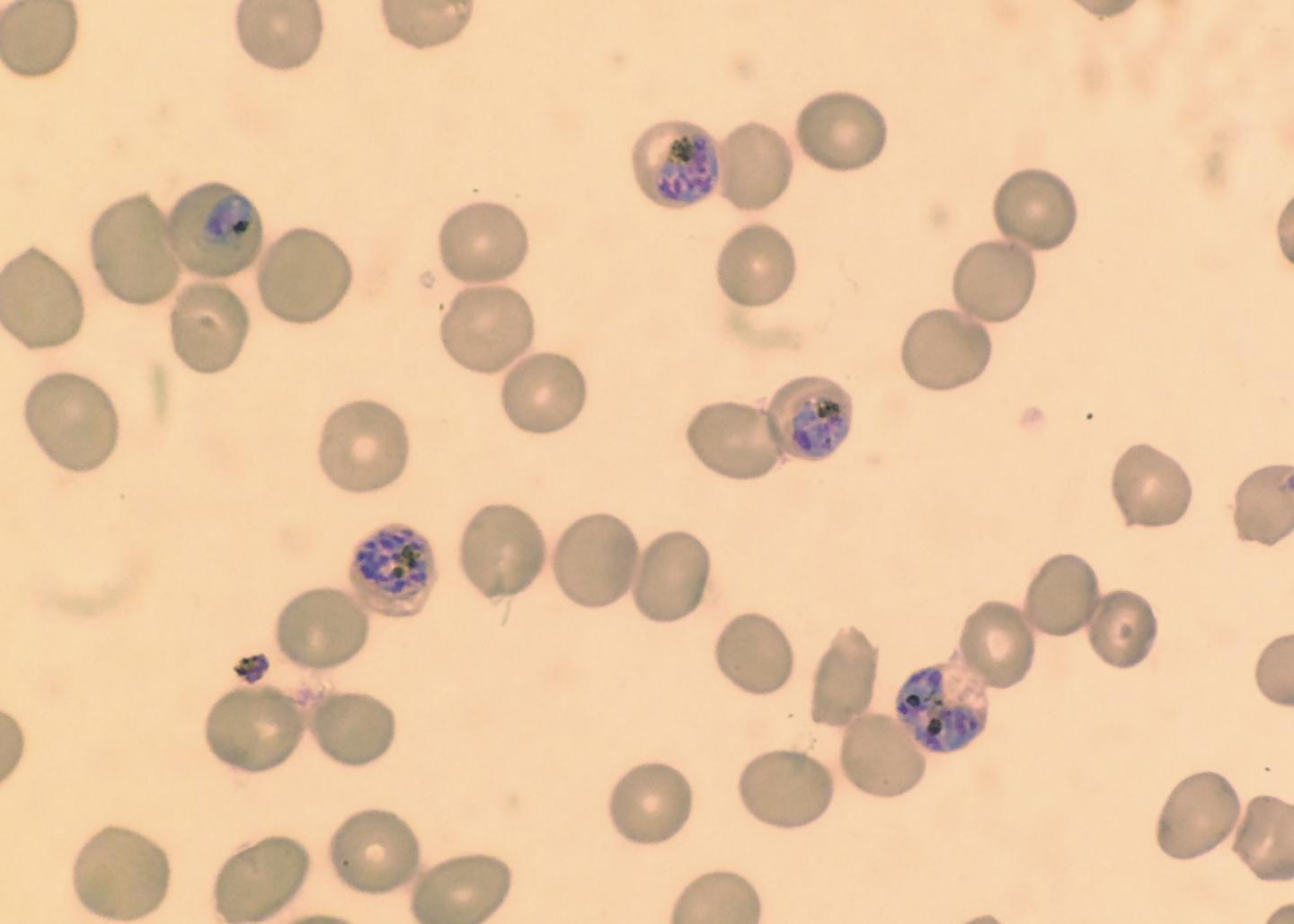 <i>Plasmodium falciparum</i>