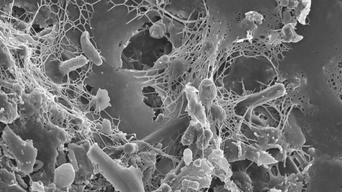 Investigating the removal of dry biofilm with probiotic cleansers