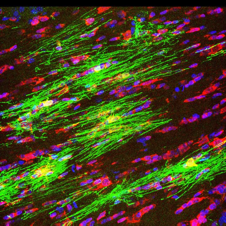 Complex Shape of Individual Oligodendrocytes