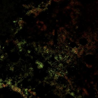 The Bacteria in Our Mouths