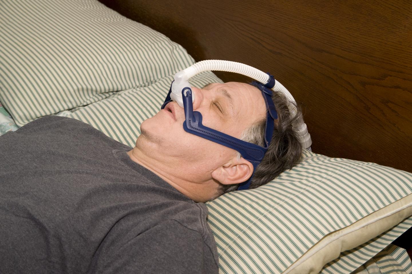 Sleep Apnea