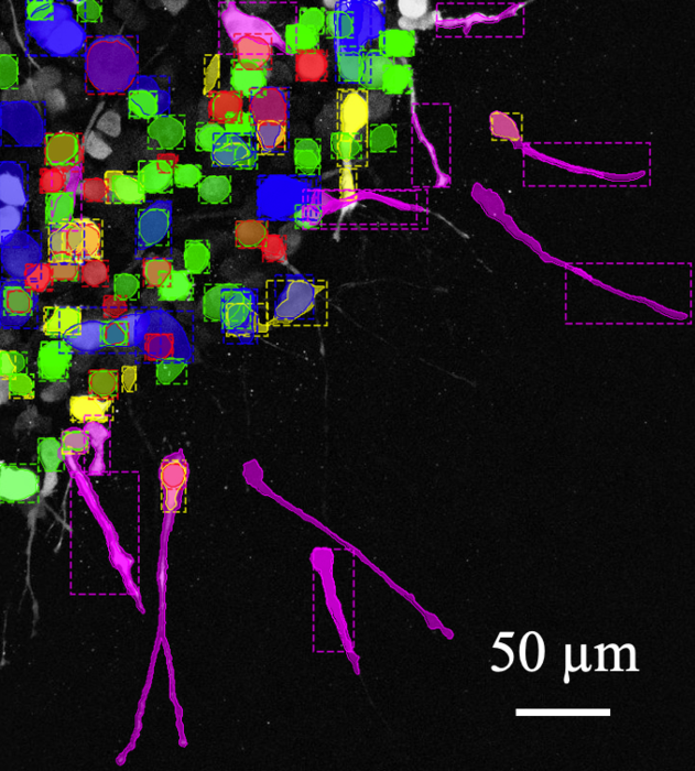 Cancer cell migration