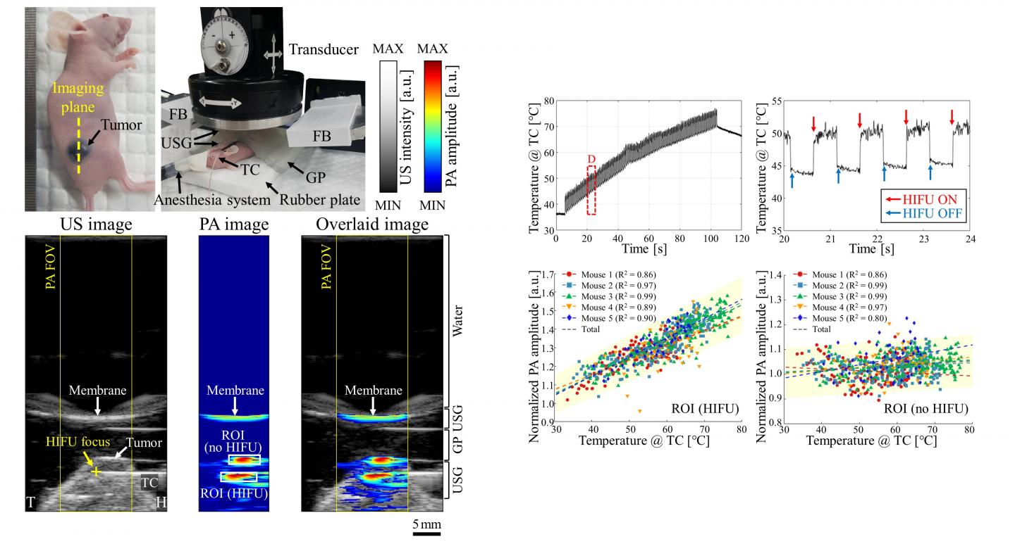 Real-Time Ultrasound and Photoacoustic Thermometry Images