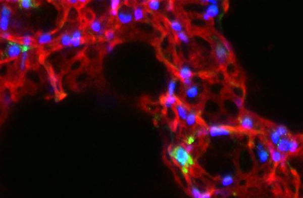 iNKT Cells in Lung Vasculature