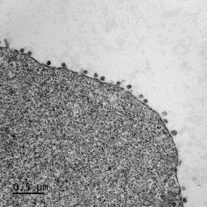 Electron microscopy image showing the accumulation of viral particles at the surface of cells derived from the brain of a bat (species: Myotis myotis).