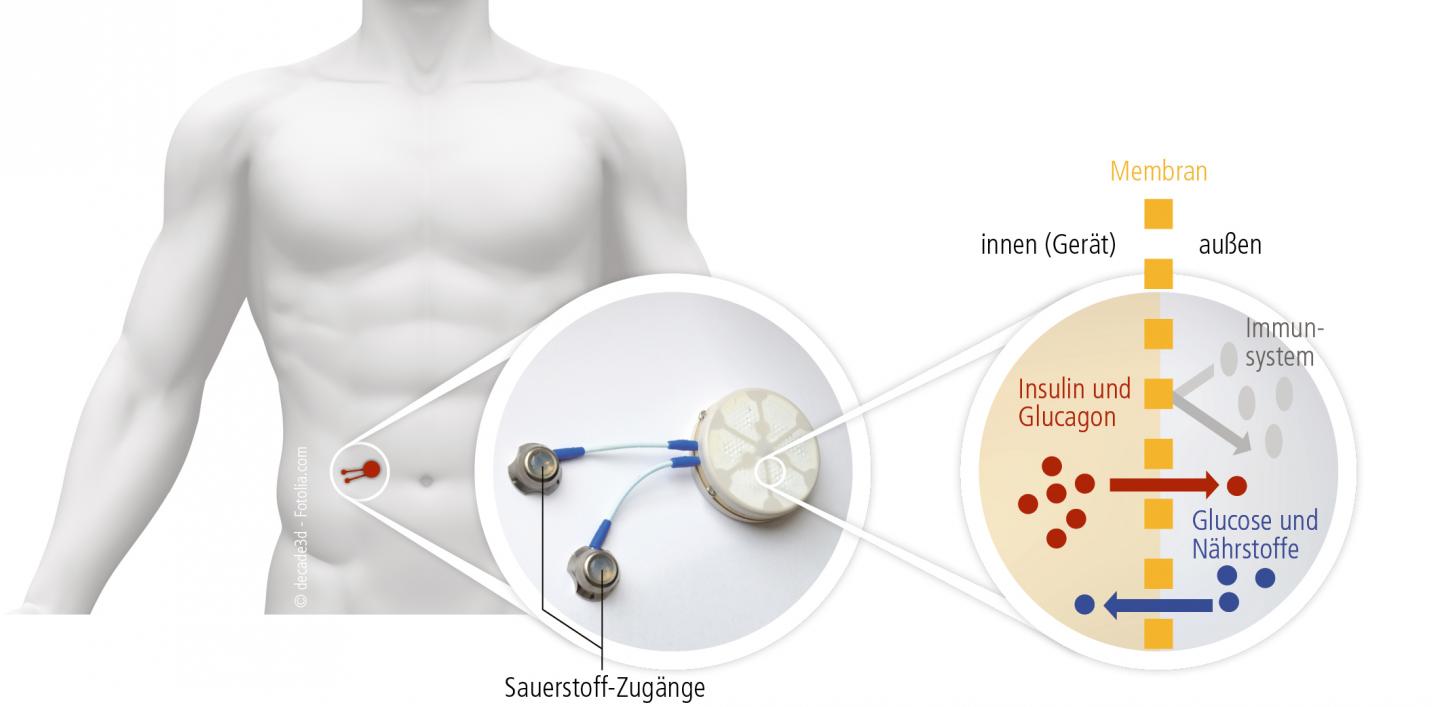 Bioreactor