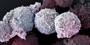 Electron microscope image of T cells.