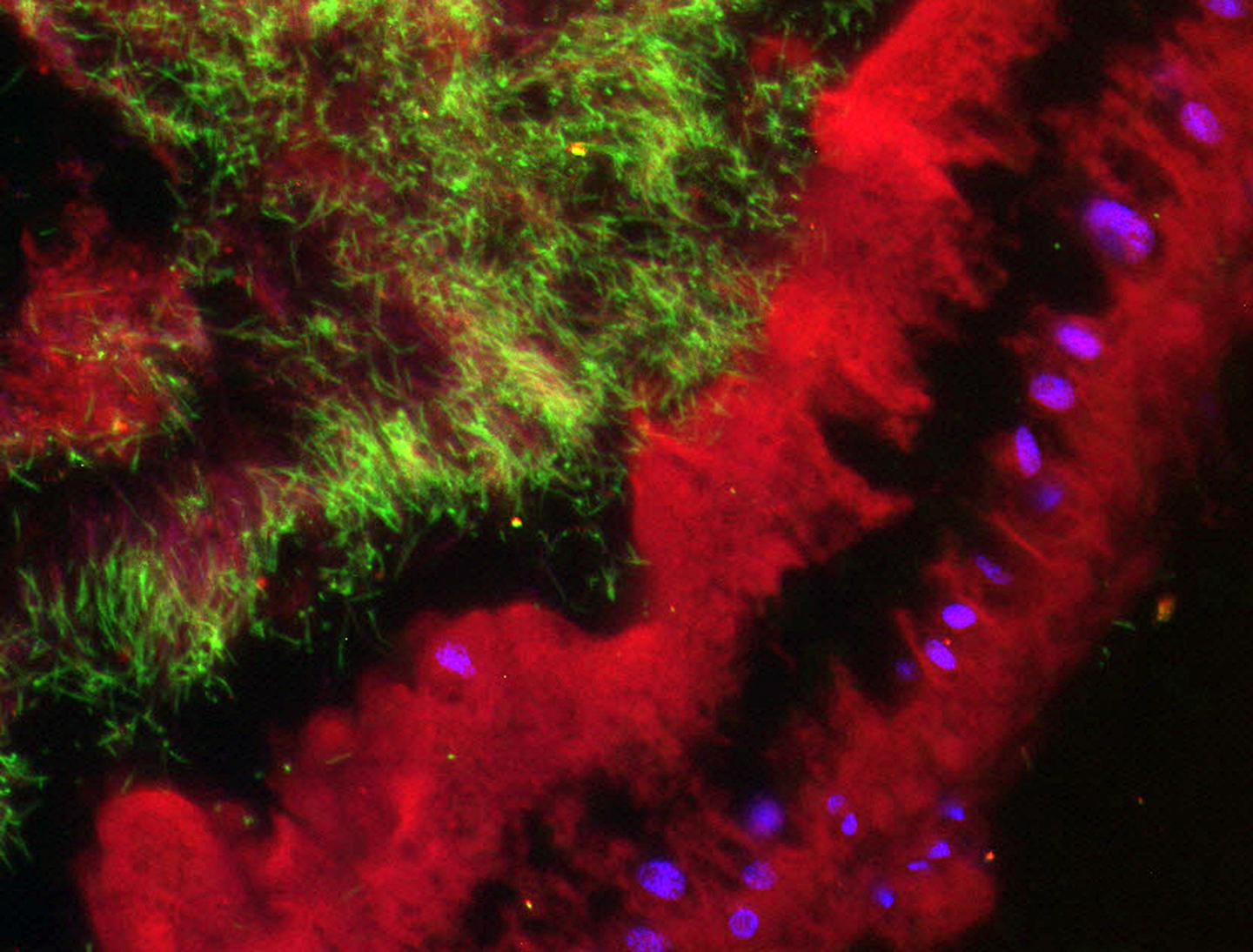 Fluorescence in situ Hybridiza [IMAGE] EurekAlert! Science News Releases