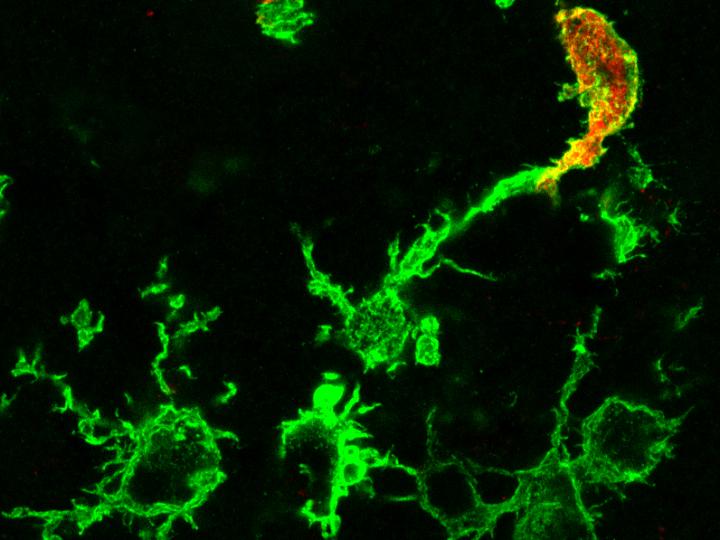 Microscopic Image of Green Stained Macrophages after a Stroke: