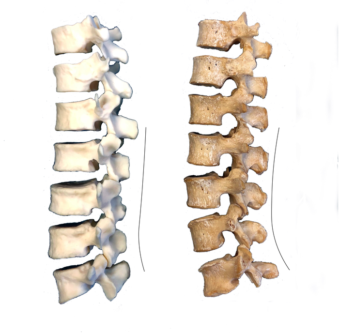 Human and Neandertal Comparison