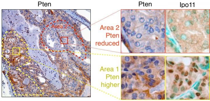 Achilles Heel of Essential Anti-cancer Protein
