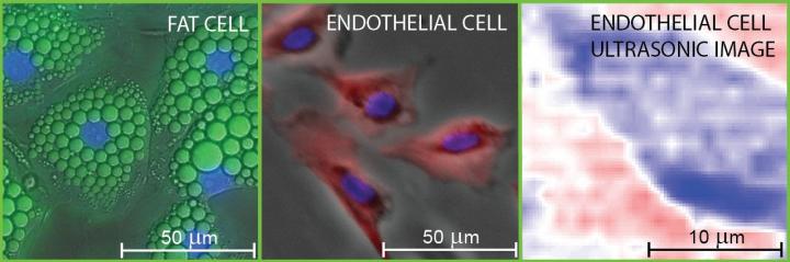 Fluorescence Micrographs of Fat and Endothelial Cells